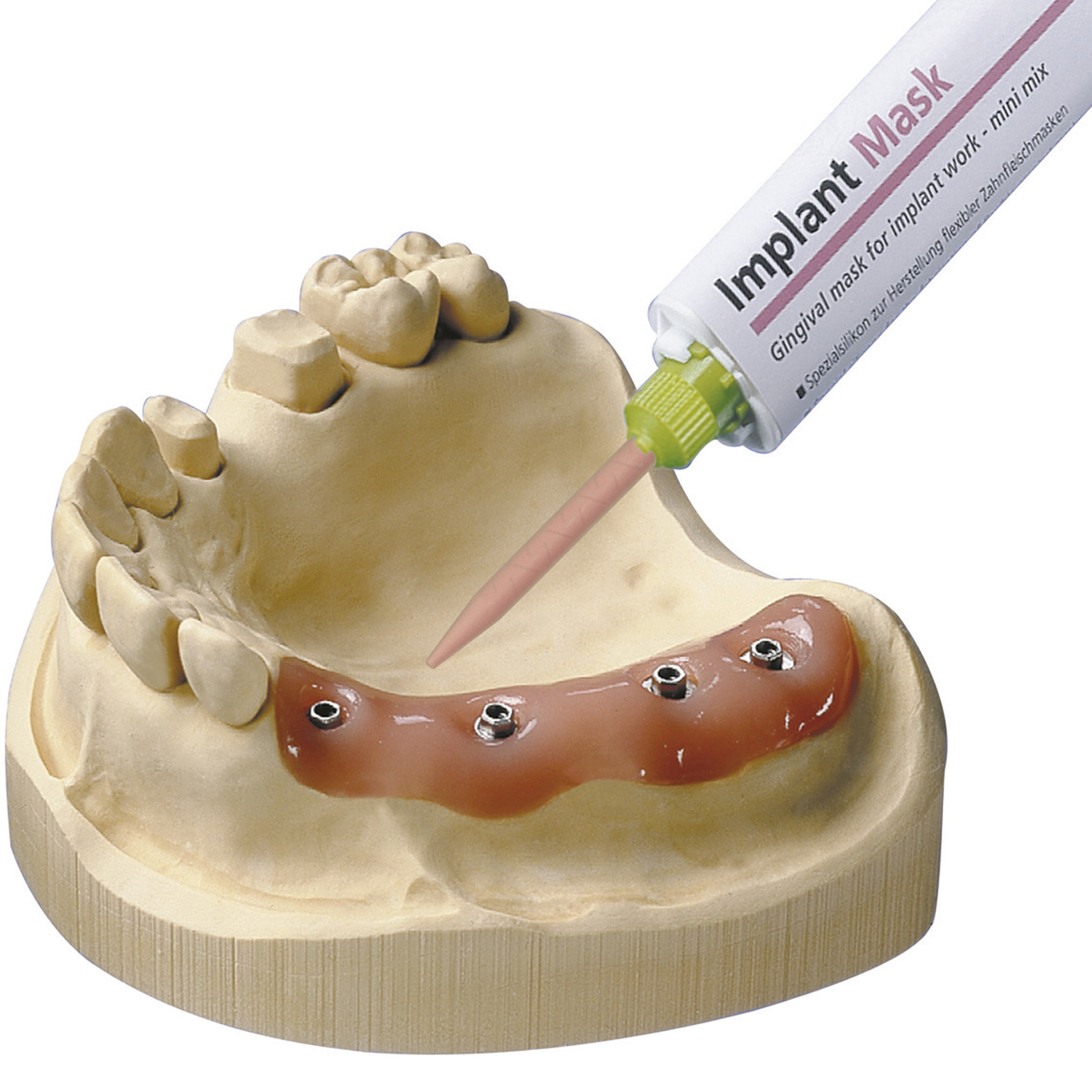 Implant Mask Gingival Mask Material - 1 set